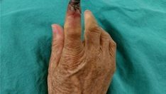 İnatçı Ağrılar İntihara Kadar Götürebiliyor!