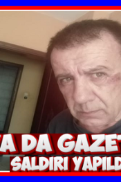 ALANYA DA GAZETECİYE YAPILAN SALDIRI YAKIŞMIYOR ÜLKEMİZE VE MİLLETİMİZE